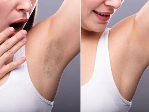 CREMA BLANQUEADORA